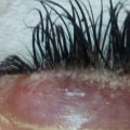 What helps natural eyelashes after extensions?