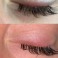How do i stop allergic reaction to eyelash extensions?