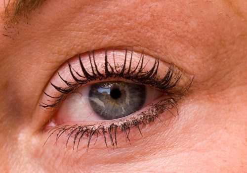 Can eyelash extension glue damage your eyes?